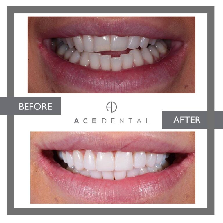 82918403 1794158130709092 5536881502232510464 o 768x768