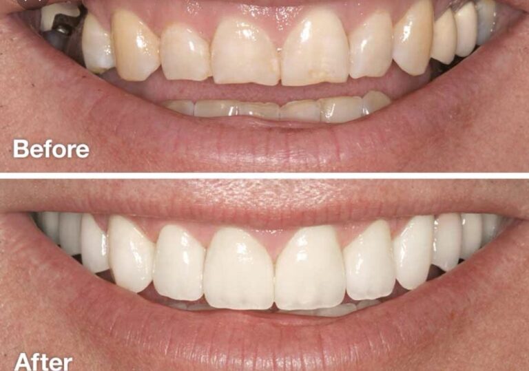 o 2020 08 29T130140.694 768x539