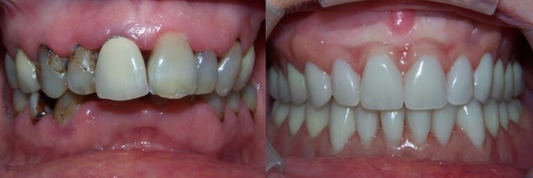 o 2020 09 16T221102.162 768x257