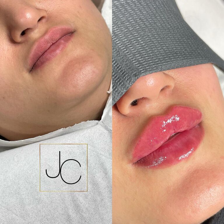 259631053 2438014346330440 6206503935066214768 n 768x768