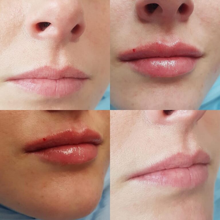 271589905 6649034005166757 7562601104314669144 n 768x768